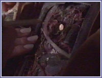 Getting the bullet out of Mac's leg